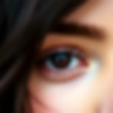 Characteristic features of brown eyes