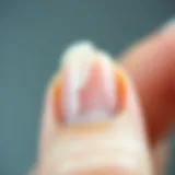 Understanding Nail Damage A close-up of a broken nail showcasing the fracture