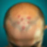 Close-up view of scalp with eczema symptoms